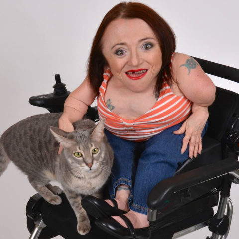 “Hashing It Out” with Jane Hash: An Activist With Osteogenesis Imperfecta